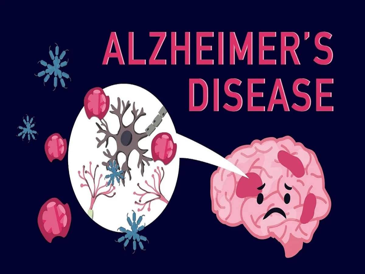 Alzheimer's Diseases: How To Take Care Of The Patient At Home